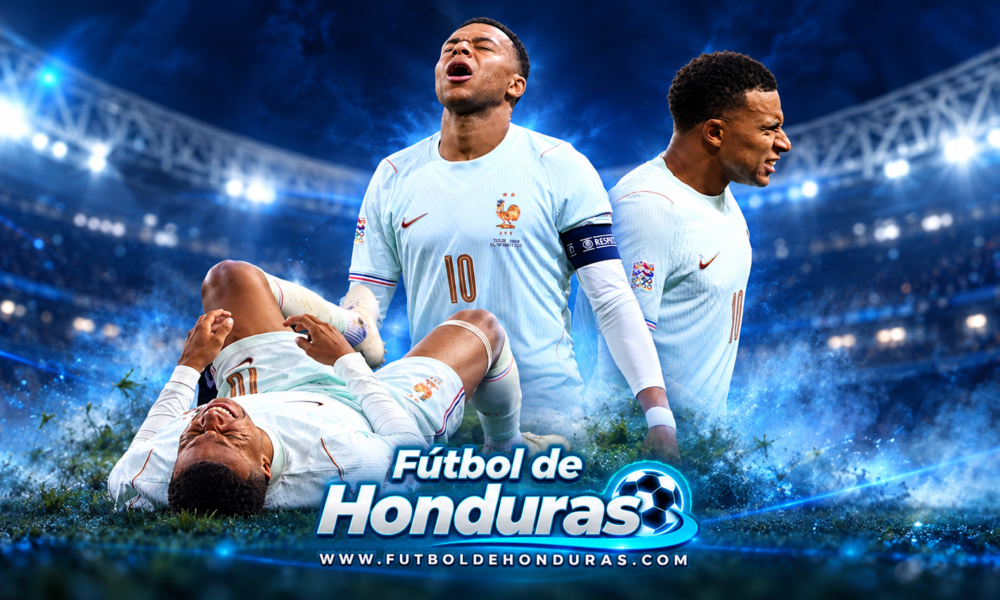 Kylian Mbappé lesionado de la rodilla izquierda